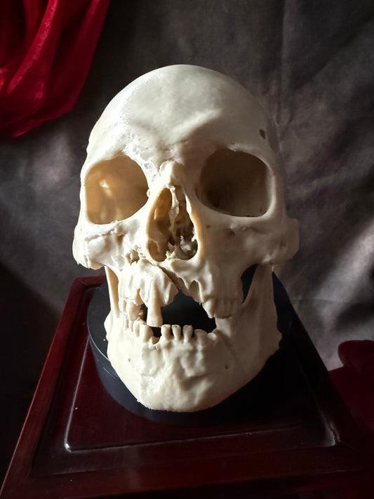 Battle Damaged Human Skull Bone Aged