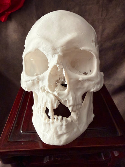Battle Damaged Human Skull Bone White